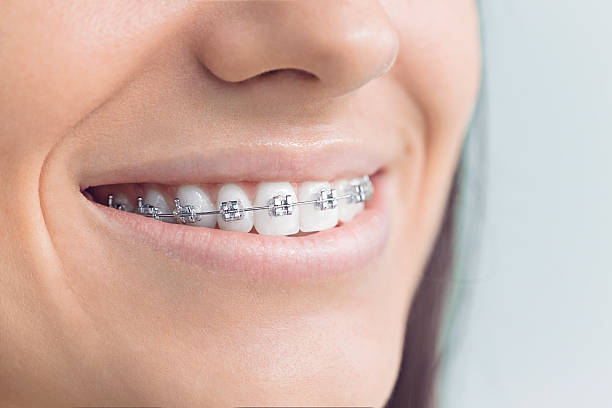 Best Dental Fillings (Composite and Amalgam)  in Poinciana, FL